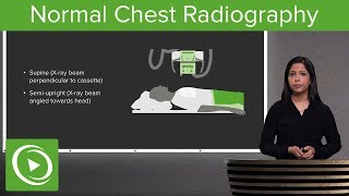 Normal Chest Radiography – Radiology  Lecturio [upl. by Deloria519]