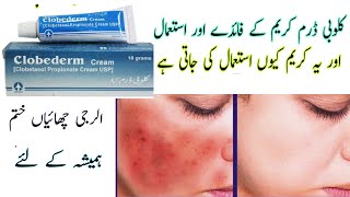 Clobederm cream uses in urdu Clobetasol Benefits  How to apply  Side effects [upl. by Mozes]