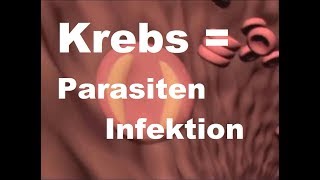 Dr Weber  1970  KREBS und Parasiten Infektionen  Selbsttest und Anleitung [upl. by Mazlack]