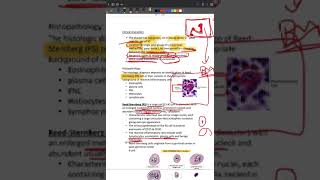 LYMPHOMA HODGKIN TYPE [upl. by Pucida285]