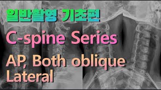 일반촬영 기초편 Cspine Series [upl. by Servais]