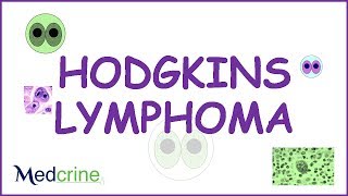 Hodgkins Lymphoma Pathophysiology symptoms and treatment [upl. by Aleahcim170]