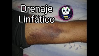 Kinesiotape para Drenaje Linfático Hematomas moretones [upl. by Dulcie]