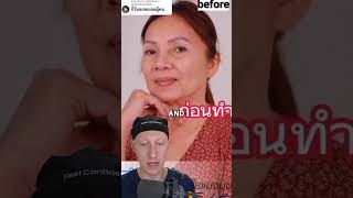 Why Does This Facelift Look Intimidating  Plastic Surgeon Reacts [upl. by Amikahs]