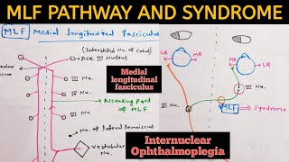 Medial Longitudinal FasciculusMLF  Pathway and MLF Syndrome  Internuclear ophthalmoplegia INO [upl. by Hasin]