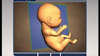 Step by Step to Get Perfect 3D4D Baby Image [upl. by Rajewski]