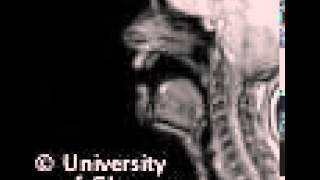 MRI voiced palatal lateralapproximant [upl. by Lednam]