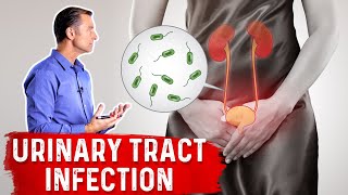 Top Natural Remedies for a UTI Urinary Tract Infection [upl. by Llevert321]