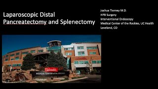 Laparoscopic distal pancreatectomy with splenectomy [upl. by Gaddi]