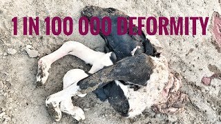 1 IN 100 000 CALF DEFORMITY Schistosomus reflexus vlog 192 [upl. by Dez336]