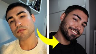 CÓMO HACER CRECER LA BARBA NATURAL Y RÁPIDO SIN MINOXIDIL [upl. by Salas]