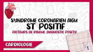 Syndrome Coronarien Aigu Segment ST Positif  Diagnostic Positif Symptomes amp ECG Complications [upl. by Wickman487]