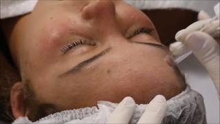 Beauty Dermo  Aparelho de Vacuoterapia e Endermoterapia [upl. by Einoj812]