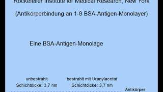 Theorie des Immunsystems Antikörper Viren und dendritische Zellen [upl. by Baelbeer]