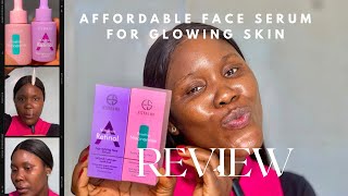 Affordable Serum for Glowing Skin  Estelin Rosehip Niacinamide amp Retinol Honest Review [upl. by Watt]