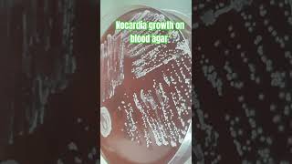 Characterizing Nocardia Colony Morphology on Blood Agar [upl. by Macfarlane]