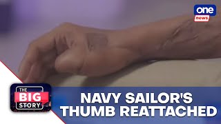 TBS  PH Navy seamans thumb reattached through medical procedure [upl. by Aizirk]