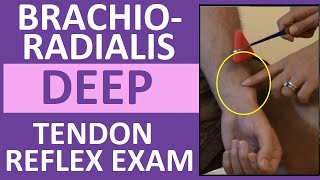 Brachioradialis Deep Tendon Reflex Examination  Nursing Head to Toe Assessment [upl. by Conard]