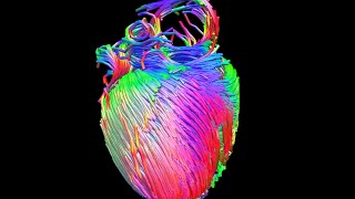 MRI diffusion tensor imaging of the heart [upl. by Zennas]