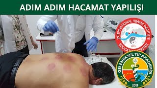 Hacamat Sırları3 Ön Vakumlama incelikleri DrN Süleyman Gök [upl. by Awe811]