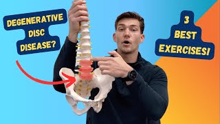 3 Best Exercises for Degenerative Disc Disease [upl. by Loginov]