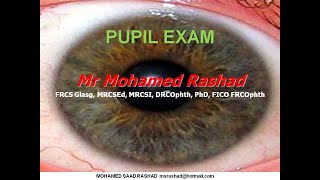 5 Steps of Pupil examination [upl. by Haskel]