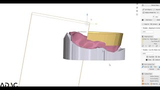 Digital Dentures From Alginate Impression to 3D Printed Bite Rims [upl. by Jeana]