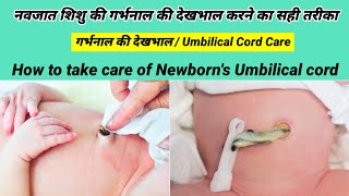 Newborn Baby ki garbhnal ki dekhbhal kaise kre। नवजात शिशु की गर्भनालनाभि का ध्यान कैसे रखें। [upl. by Krystyna]