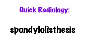 QUICK RADIOLOGY Radiologic findings of Spondylolisthesis [upl. by Rehctelf]