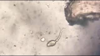 Schistosoma japonicum forktailed cercariae part 1 [upl. by Retsila]