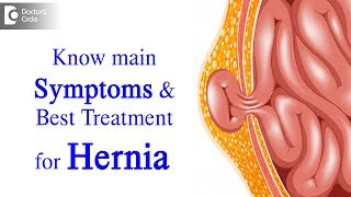 What is Hernia Symptoms Causes Types Treatment  Dr Harish N S  Doctors Circle [upl. by Stambaugh]