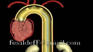 IABP Intraaortic Ballon Pump [upl. by Alley451]