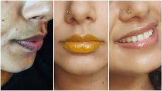 How I get rid of Pigmented Lips Naturally  Real Lip Care Routine to get soft pink lips Home Remedy [upl. by Anina]