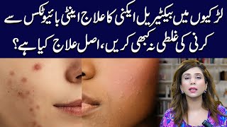 Bacterial Acne Treatment for Girls Top Tips and Tricks  Dr Sahar Chawla [upl. by Ellesij]