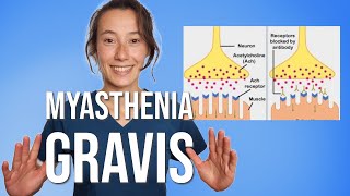 Myasthenia Gravis [upl. by Jennica]