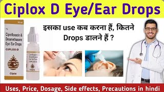 Ciplox d eye ear drops  Ciprofloxacindexamethasone eye ear drops ciplox d  Ciplox d eye drops [upl. by Carlene379]