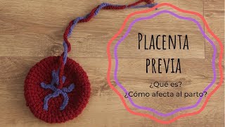 PLACENTA PREVIA o PLACENTA BAJA · ¿Qué es ¿Cómo afecta al parto [upl. by Aihgn79]