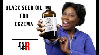 BLACK SEED OIL FOR SKIN CLEARS UP ECZEMA AND ACNE FAST [upl. by Marsland329]