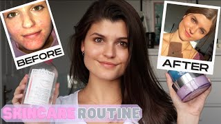 GLOWY SKINCARE ROUTINE l MY PERIORAL DERMATITIS JOURNEY l LIVEFITELLE [upl. by Yrag]