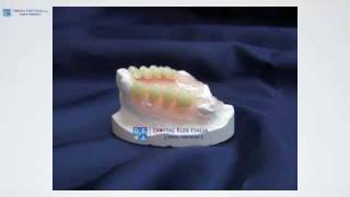 Protesi Flessibili  Dental Flex Italia [upl. by Sinnaiy]