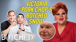 Victoria Pork Chops BOTCHED Snout Needs Surgery TWICE BEFORE amp AFTER  Botched  E [upl. by Ahsatniuq650]