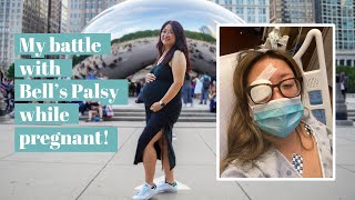 My Sudden Bells Palsy Diagnosis while Pregnant at 40  Chef Julie Yoon [upl. by Aliekahs]