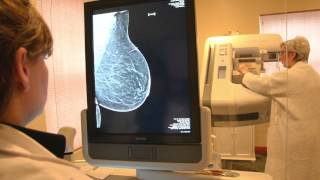 ZP Rad  What is Breast Tomosynthesis [upl. by Aiela]