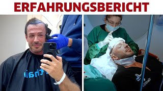 Meine HaartransplantationHaarverdichtung in Istanbul Erfahrungsbericht [upl. by Fiedler]