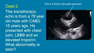 Test your echocardiography skills with Echo Research and Practice [upl. by Nylac658]