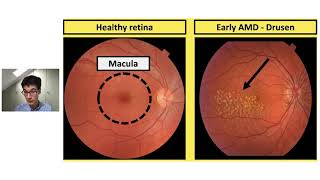 The macula A users guide Alasdair Warwick [upl. by Arihppas]