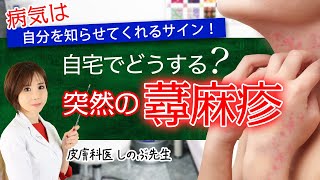 【自宅で突然の蕁麻疹どうする？】とるべき行動 市販薬は効く？病気は自分を知らせてくれるサイン！ [upl. by Aihk980]