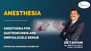 Anesthesia  Anesthesia for Gastroschisis and Omphalocele Repair  Raaonline anesthesia [upl. by Baiss]