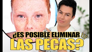 Cómo Eliminar Las Pecas de La Cara  Yasmany [upl. by Hartley787]