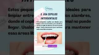 5 Tips para cuidar tu higiene dental si usas brackets bracket clinicadental sonrisaperfecta [upl. by Sirois]